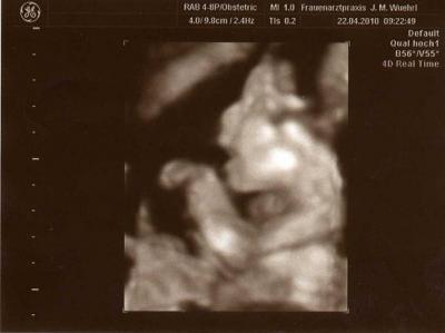 Bild zu war heut fa wegen schmerzen - Forum für September - Mamis