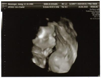 Bild zu Heute Organscreening u. 3D Bild - Forum für September - Mamis