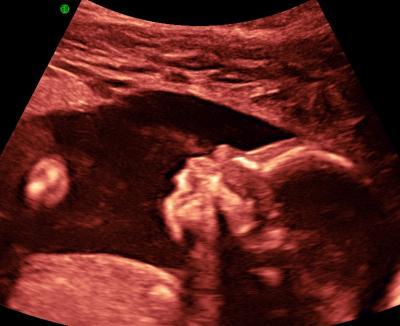 Bild zu Organscreening - Unterstützung für die ... - Forum für September - Mamis