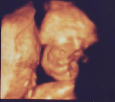 Bild zu Und hier die versprochenen Bilder... - Forum für September - Mamis