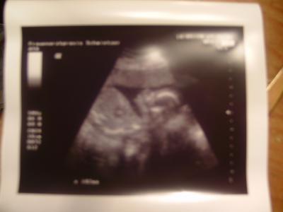 Bild zu Darf ich vorstellen? Baby-Girl :D - Forum für September - Mamis