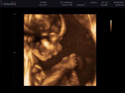 Bild zu Heute 3D/4D gehabt - Forum für September - Mamis