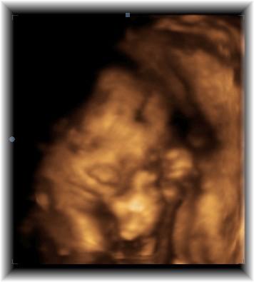 Bild zu mein kleiner sonnenschein - Forum für September - Mamis