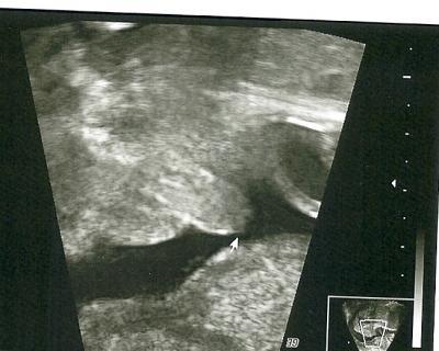 Bild zu 3. US mit erstaunlicher Wendung - Forum für September - Mamis