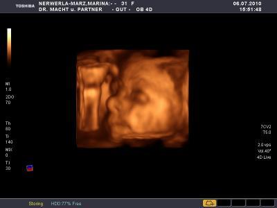 Bild zu VU vorgestern - Forum für September - Mamis