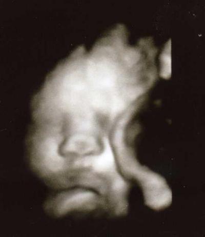 Bild zu bisschen traurig heute... :-( - Forum für September - Mamis