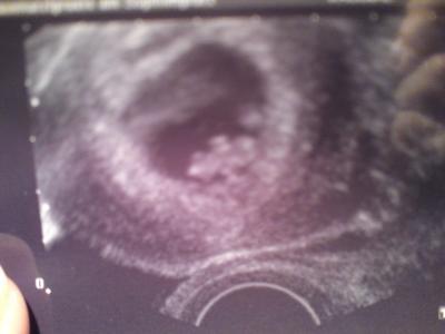 Bild zu Heute ausserplanmäßig FA Termin gehabt - Forum für September - Mamis