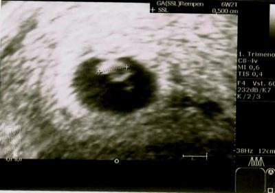 Bild zu entwarnung - Forum für September - Mamis
