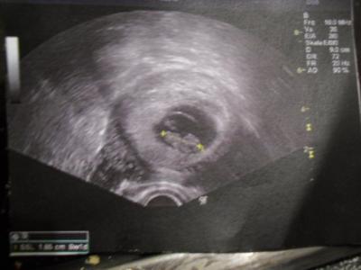 Bild zu wieder daaa - Forum für September - Mamis