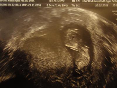 Bild zu Gestern ungeplanter Fa Termin - wegen den Krämpfen - Forum für September - Mamis