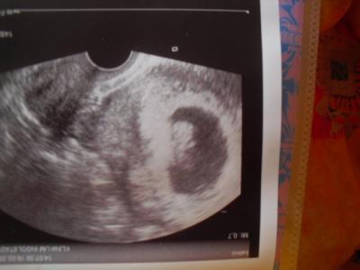 Bild zu bin wieder daheim.... - Forum für September - Mamis