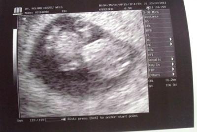Bild zu alles easy - Forum für September - Mamis