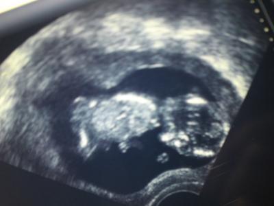 Bild zu Da wir ja alle auf Bilder stehen, gibt es auch von mir nochmal 2 :) - Forum für September - Mamis
