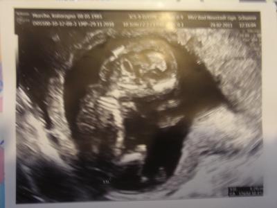 Bild zu Auch Bild &#9829; und Bericht - Forum für September - Mamis