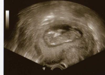 Bild zu Meine Süßen... - Forum für September - Mamis