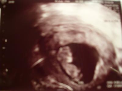 Bild zu Zurück vom FA und soooo glücklich!!!! :) - Forum für September - Mamis