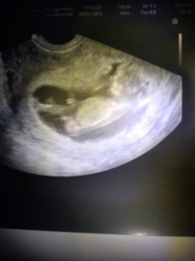 Bild zu Zurück vom Fa...und Bildchen - Forum für September - Mamis