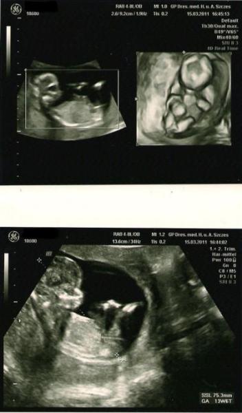 Bild zu Fotos vom US - Forum für September - Mamis