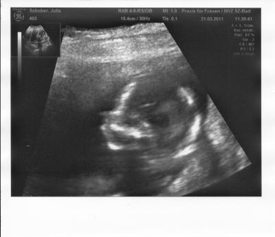 Bild zu ausserplanmäßig bei meiner FÄ gewesen - Forum für September - Mamis