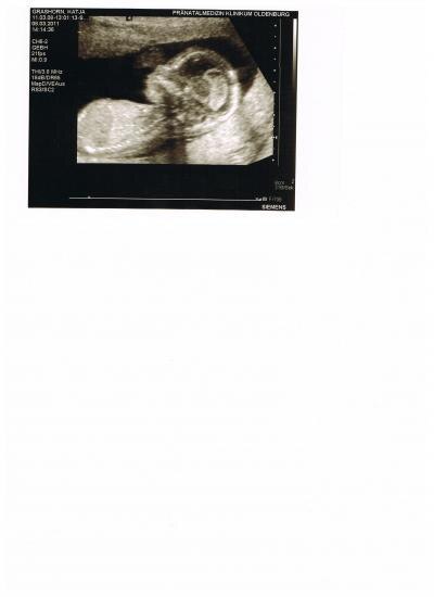 Bild zu Und hier endlich mal ein US-Bild von meiner Tochter - Forum für September - Mamis