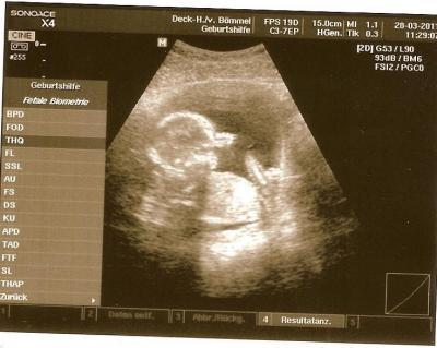 Bild zu Ungeplanter besuch beim Fa - Forum für September - Mamis