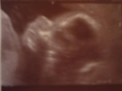 Bild zu Heute auch VU und 100% Outing:-) - Forum für September - Mamis