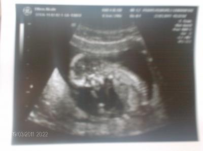 Bild zu Möchte euch auch gern mal meinen mitbewohner zeigen - Forum für September - Mamis