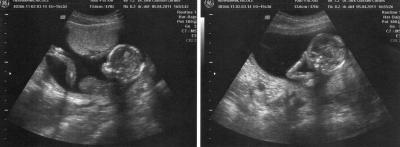 Bild zu Auch zurück von der VU mit Outing und süssen Fotos ;-) - Forum für September - Mamis