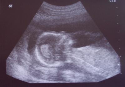 Bild zu Tolle VU mit 90%igem Outing! - Forum für September - Mamis