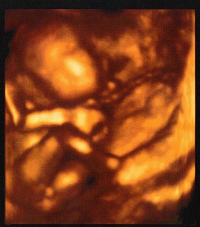 Bild zu Hier mal mein zeigefreudiger Sohn in 4 D - Forum für September - Mamis