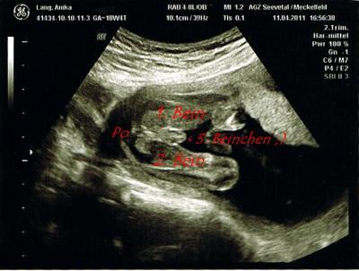 Bild zu Es ist ein Junge, aber sowas von! :) - Forum für September - Mamis