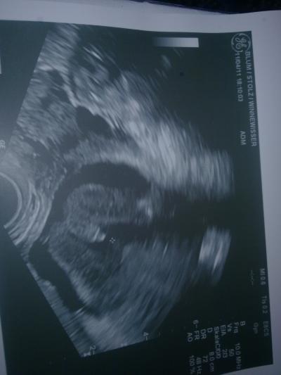 Bild zu Ein 100%iges Outing!! :)) - Forum für September - Mamis