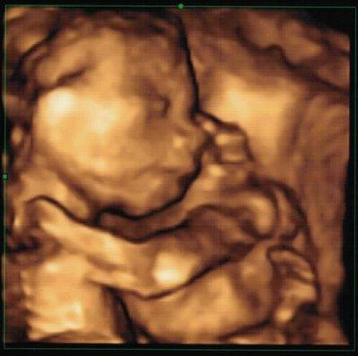 Bild zu Outing zu 90 Prozent :) - Forum für September - Mamis