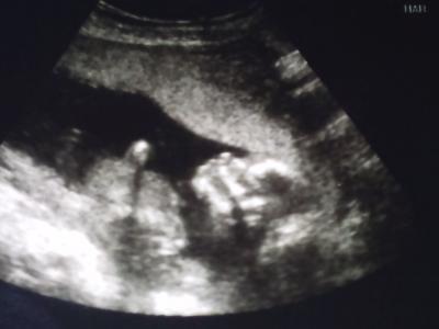 Bild zu Fotos von meiner Schnecke!!! - Forum für September - Mamis