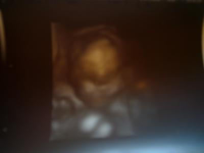 Bild zu Heute VU und 3D:o) - Forum für September - Mamis