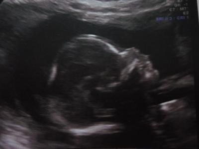 Bild zu Komme von der Feindiagnostik...+ Bildchen! - Forum für September - Mamis