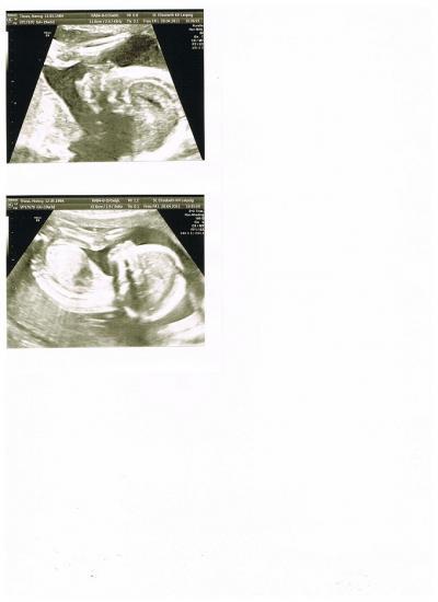 Bild zu @sweetheart17 - Forum für September - Mamis