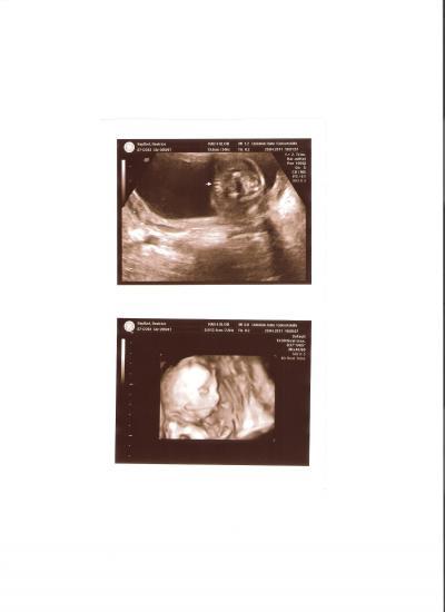 Bild zu Endlich Gewissheit!!! Juhu!!! - Forum für September - Mamis