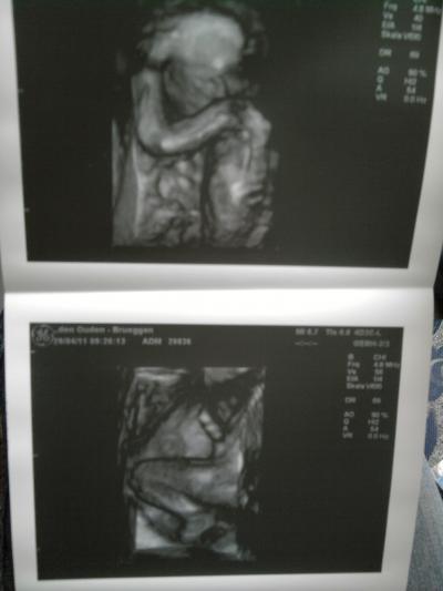 Bild zu Bild von heutigem US - Forum für September - Mamis