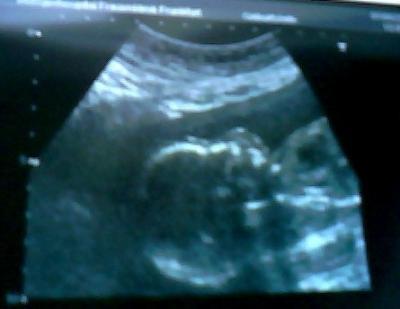 Bild zu Heute VU und Bilder :-) - Forum für September - Mamis