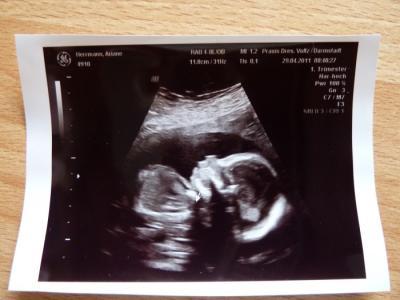 Bild zu Baby-Bildchen - Forum für September - Mamis