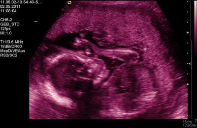 Bild zu bericht von gestern (fd) - Forum für September - Mamis