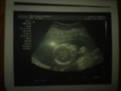 Bild zu VU + Outing - Forum für September - Mamis