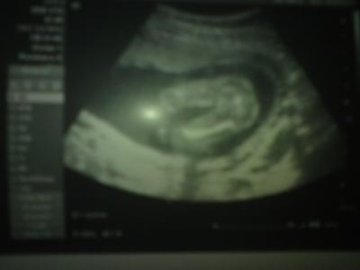 Bild zu Outing Bild - Forum für September - Mamis