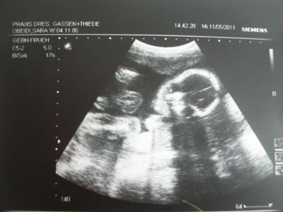 Bild zu gerstern VU + Outing! :-D - Forum für September - Mamis