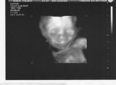 Bild zu Heute war FD.... - Forum für September - Mamis