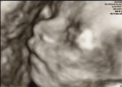 Bild zu Wollte euch mal meinen Sohn vorstellen :-) - Forum für September - Mamis