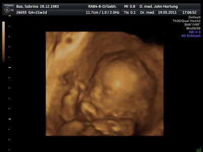 Bild zu zurück von der FD uuund.... - Forum für September - Mamis