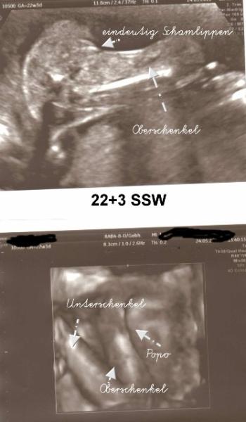 Bild zu Jetzt steht es fest, wir bekommen... - Forum für September - Mamis