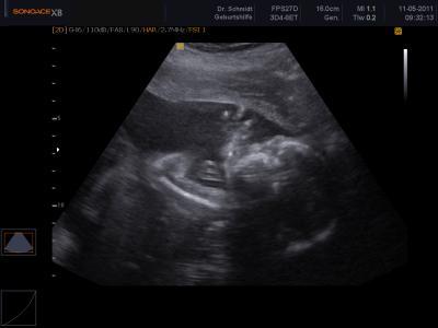 Bild zu Mal unsere Kleine zeigen muss - Forum für September - Mamis